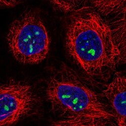 ATP13A3 Antibody, Novus Biologicals 0.1mL; Unlabeled:Antibodies, Polyclonal